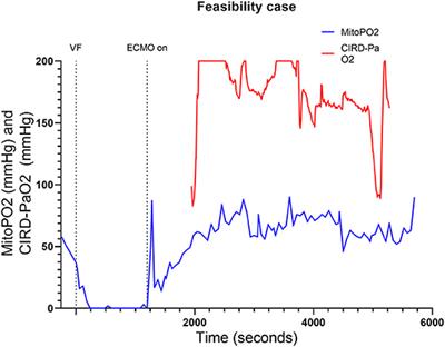 Monitoring Mitochondrial Partial Oxygen Pressure During Cardiac Arrest and Extracorporeal Cardiopulmonary Resuscitation. An Experimental Pilot Study in a Pig Model